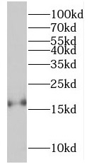 RBP5 antibody|RBP5抗体