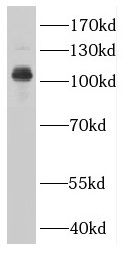 MIA2 antibody|MIA2抗体