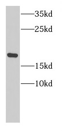 NCBP2 antibody|NCBP2抗体