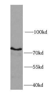 IKBKB antibody|IKBKB抗体 FNab042