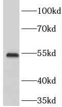 TOM1 antibody|TOM1抗体 FNab08855