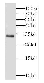 CAPZA1 antibody|CAPZA1抗体 FNab0