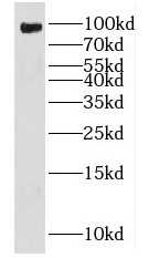 FXR2 antibody|FXR2抗体