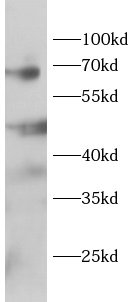 TRAF5 antibody|TRAF5抗体 FNab100