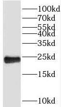PEBP1 antibody|PEBP1抗体