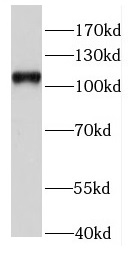 HAUS6 antibody|HAUS6抗体