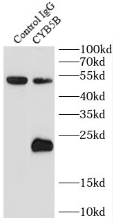 CLTB antibody|CLTB抗体