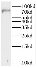 SLC5A3 antibody|SLC5A3抗体