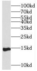 PLA2G1B antibody|PLA2G1B抗体