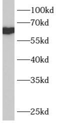 B4GALNT1 antibody|B4GALNT1抗体