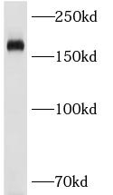 CD206 antibody|CD206抗体 FNab099