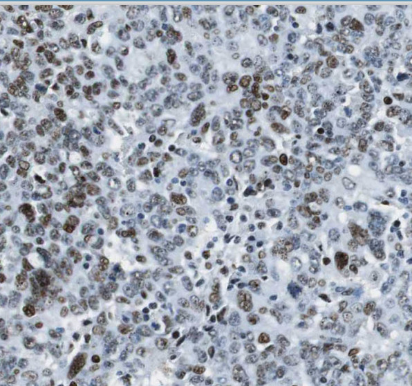 THOC6 antibody|THOC6抗体