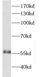 DDX19B antibody|DDX19B抗体