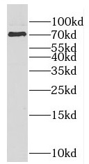 F2 antibody|F2抗体