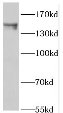 PTPN14 antibody|PTPN14抗体