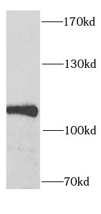 SECISBP2 antibody|SECISBP2抗体