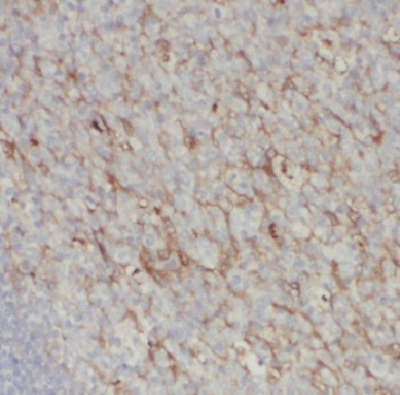CD2 antibody|CD2抗体 FNab01437