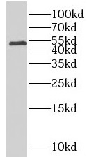 SLC44A1 antibody|SLC44A1抗体