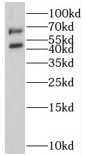 SSTR5 antibody|SSTR5抗体