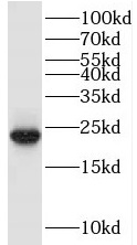 TRAPPC1 antibody|TRAPPC1抗体