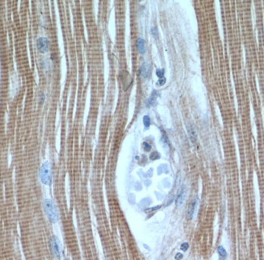 TNNI1 antibody|TNNI1抗体 FNab088