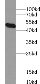 ACADSB antibody|ACADSB抗体