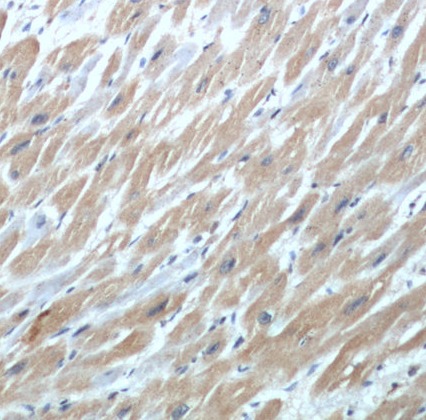 cTnI antibody|cTnI抗体 FNab01273