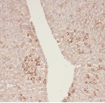 ADHFE1 antibody|ADHFE1抗体 FNab0