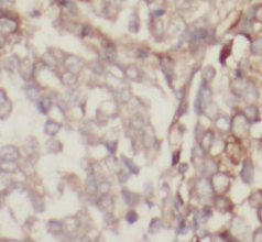 TNFAIP1 antibody|TNFAIP1抗体 FNa