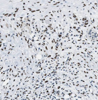 ANP32B antibody|ANP32B抗体 FNab0