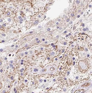 GALC antibody|GALC抗体 FNab03308