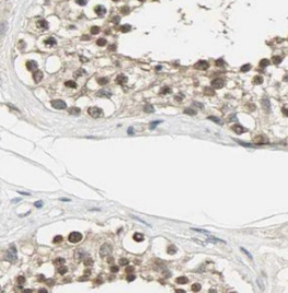 TSNAXIP1 antibody|TSNAXIP1抗体