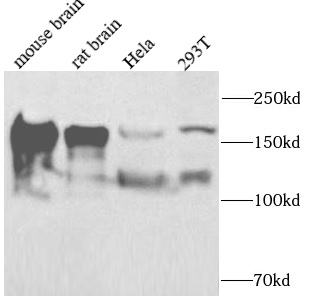 PER2 antibody|PER2抗体 FNab10090