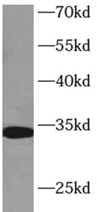 Histone H1.2 antibody|Histone 