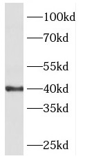 PHKG1 antibody|PHKG1抗体
