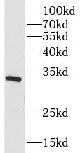 SLC25A20 antibody|SLC25A20抗体