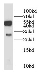 GALC antibody|GALC抗体 FNab03306
