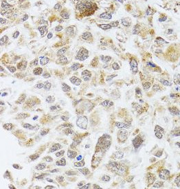 RNASEL antibody|RNASEL抗体