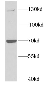 PTPRA antibody|PTPRA抗体