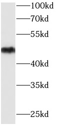 ENO2 antibody|ENO2抗体 FNab05867