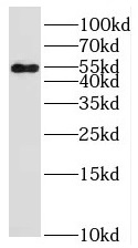 ST3GAL2 antibody|ST3GAL2抗体