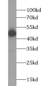 ACADL antibody|ACADL抗体