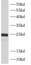 ARL4A antibody|ARL4A抗体