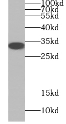 GP repeat antibody|GP repeat抗体