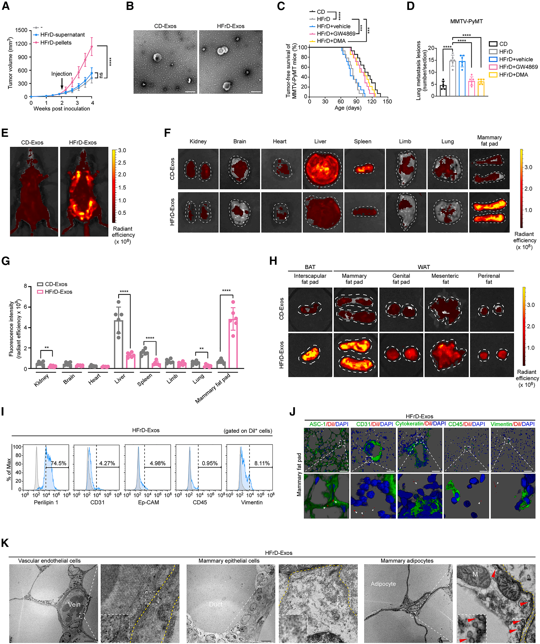 Cell Metabolism | 脂肪肝竟是乳腺癌的“远程指挥官”？科学家揭秘它的致癌信使