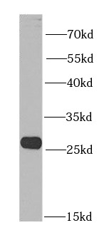 BNIP1 antibody|BNIP1抗体