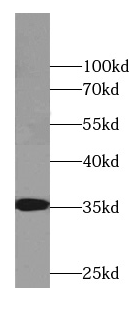 CYB5R3 antibody|CYB5R3抗体 FNab0
