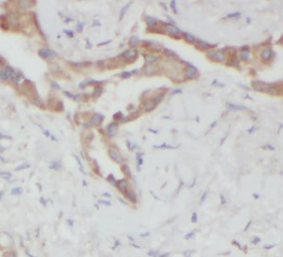 HIKESHI antibody|HIKESHI抗体 FNa