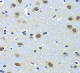 PAX7 antibody|PAX7抗体