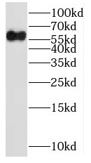 NOC4L antibody|NOC4L抗体